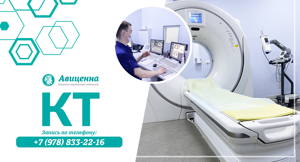 Что такое кт в медицине. Эко кт. Авиценна Симферополь проспект Победы 33а. Кт Континент.